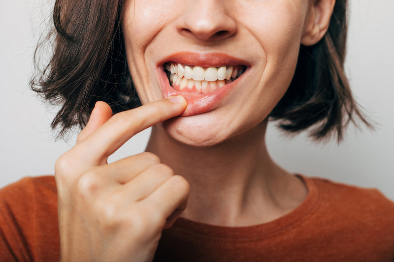 Patient smiling after getting cosmetic dentistry